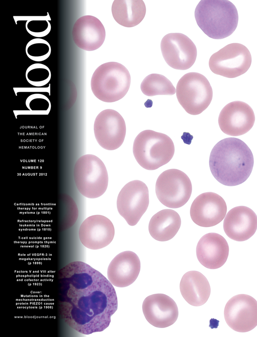 Blood Cover Image for Volume 120, Issue 9