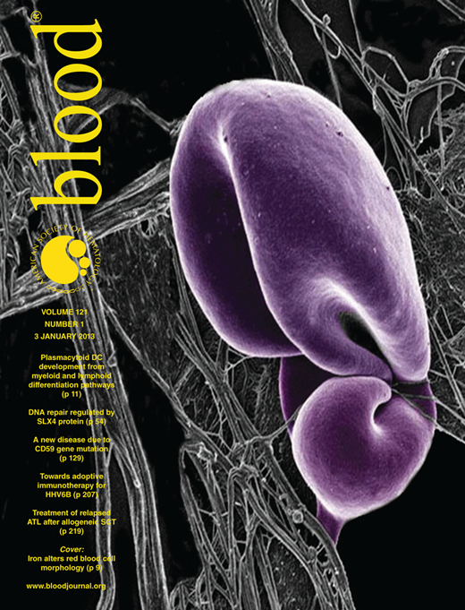 Blood Cover Image for Volume 121, Issue 1