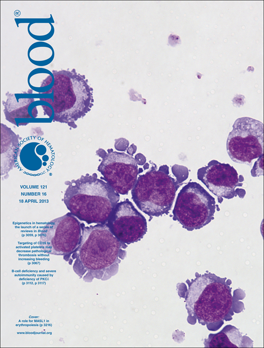 Blood Cover Image for Volume 121, Issue 16