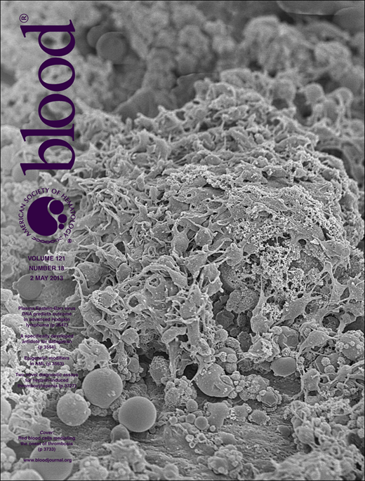 Blood Cover Image for Volume 121, Issue 18
