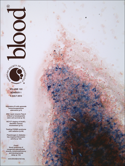 Blood Cover Image for Volume 122, Issue 1