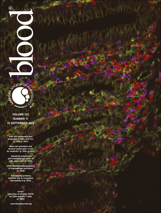 Blood Cover Image for Volume 122, Issue 11