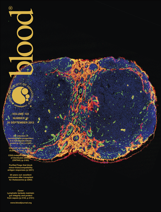 Blood Cover Image for Volume 122, Issue 13