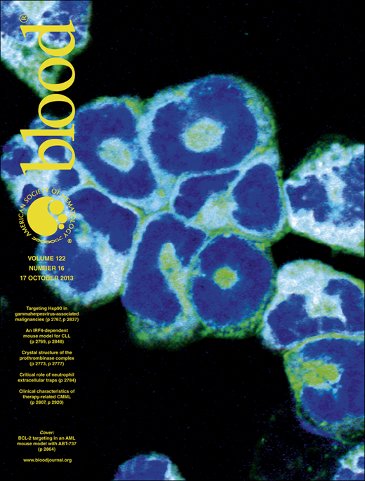 Blood Cover Image for Volume 122, Issue 16