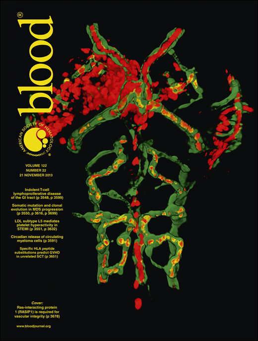 Blood Cover Image for Volume 122, Issue 22