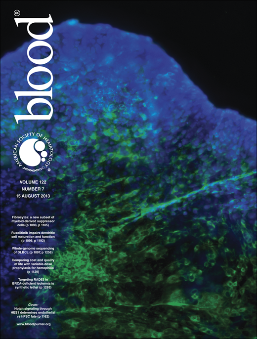 Blood Cover Image for Volume 122, Issue 7