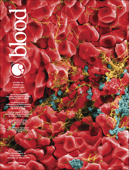 Blood Cover Image for Volume 123, Issue 10