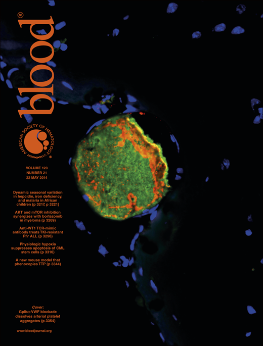 Blood Cover Image for Volume 123, Issue 21