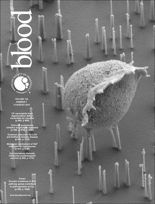 Blood Cover Image for Volume 124, Issue 7