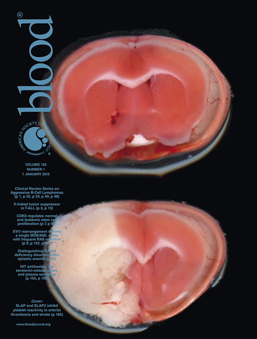 Blood Cover Image for Volume 125, Issue 1