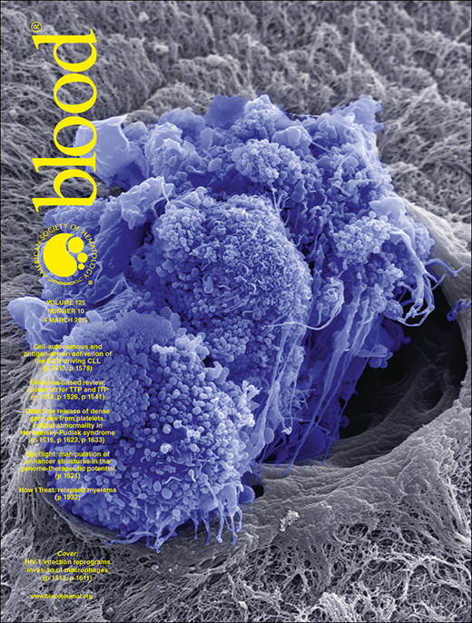 Blood Cover Image for Volume 125, Issue 10