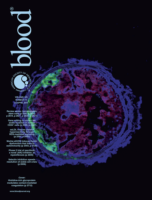 Blood Cover Image for Volume 125, Issue 17