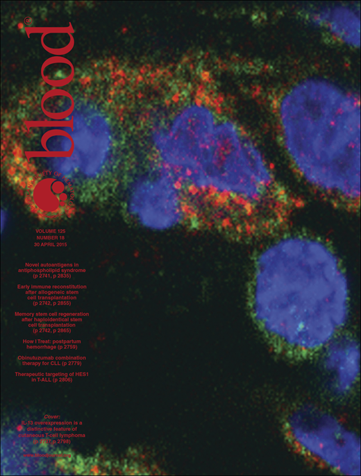 Blood Cover Image for Volume 125, Issue 18