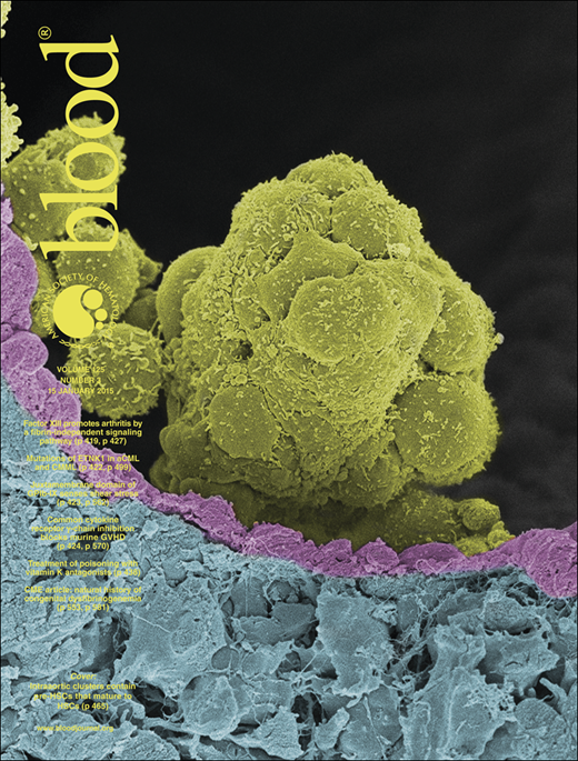 Blood Cover Image for Volume 125, Issue 3