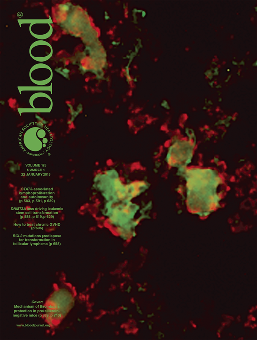 Blood Cover Image for Volume 125, Issue 4