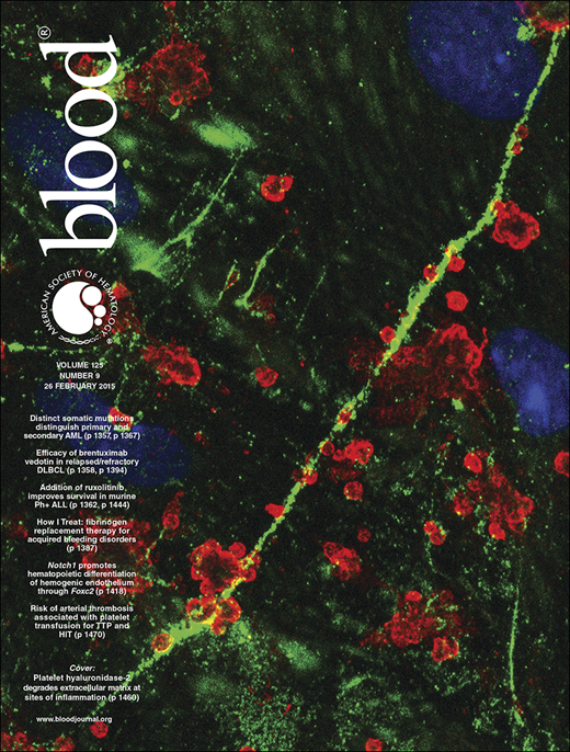 Blood Cover Image for Volume 125, Issue 9
