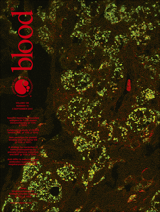 Blood Cover Image for Volume 126, Issue 10