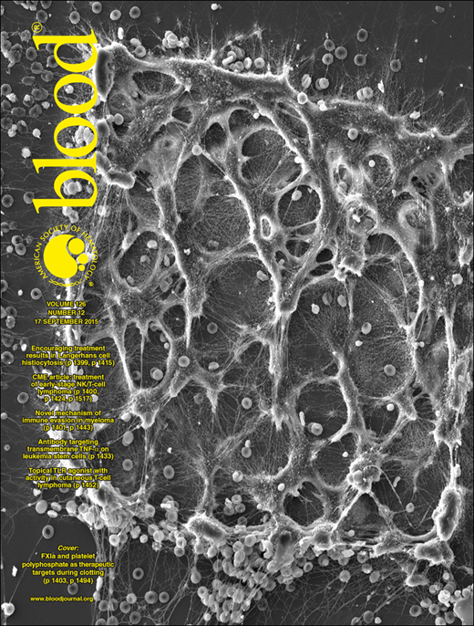 Blood Cover Image for Volume 126, Issue 12