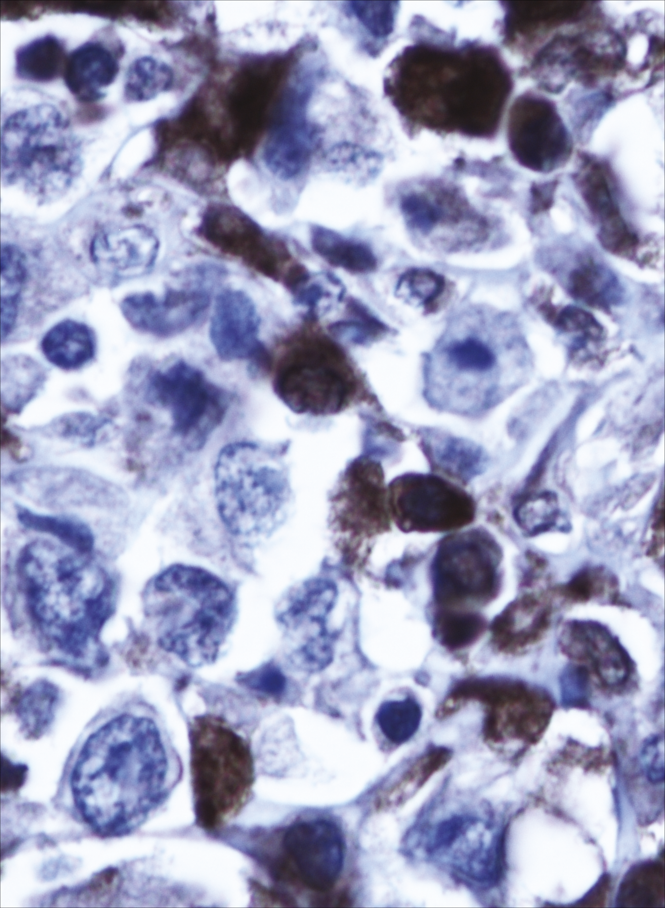 issue cover