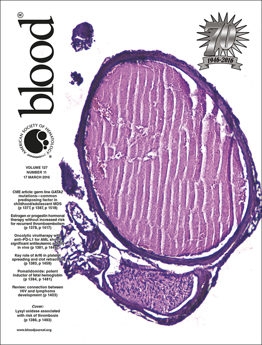 Blood Cover Image for Volume 127, Issue 11