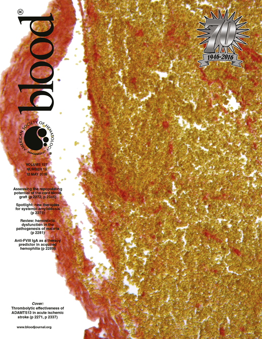 Blood Cover Image for Volume 127, Issue 19