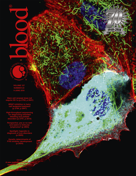 Blood Cover Image for Volume 127, Issue 23