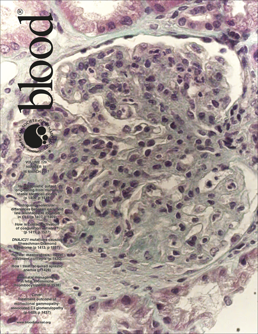 Blood Cover Image for Volume 129, Issue 11