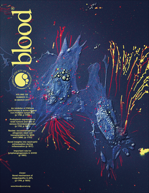 Blood Cover Image for Volume 129, Issue 13
