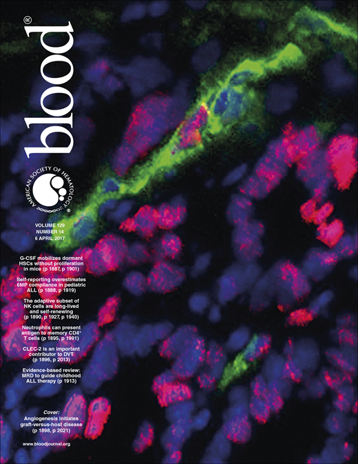 Blood Cover Image for Volume 129, Issue 14