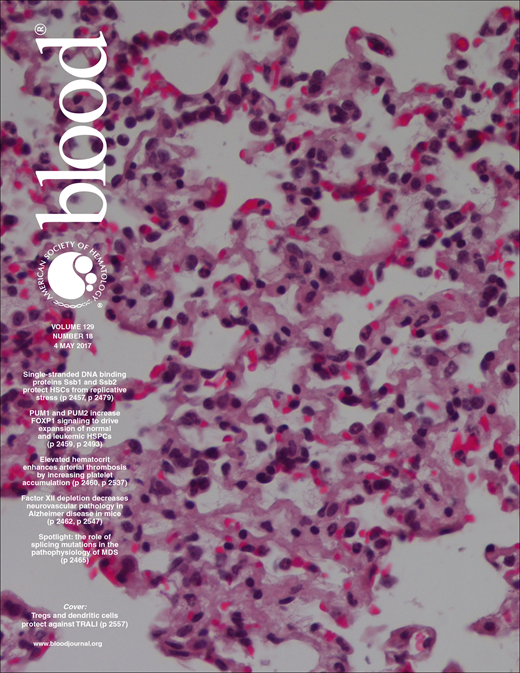 Blood Cover Image for Volume 129, Issue 18