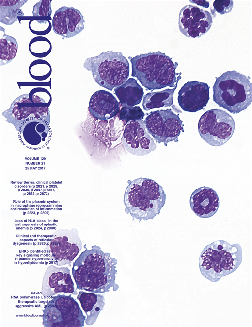 Blood Cover Image for Volume 129, Issue 21