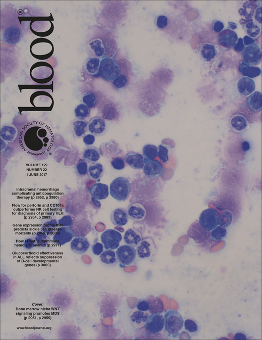 Blood Cover Image for Volume 129, Issue 22