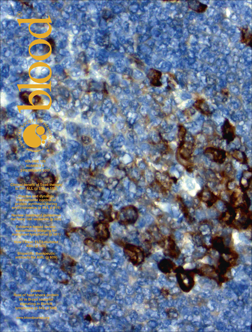 Blood Cover Image for Volume 129, Issue 5