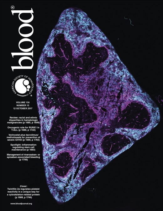 Blood Cover Image for Volume 130, Issue 15