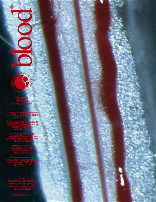 Blood Cover Image for Volume 130, Issue 20