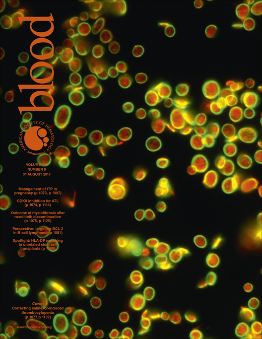 Blood Cover Image for Volume 130, Issue 9