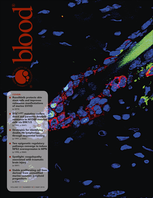 Blood Cover Image for Volume 131, Issue 18
