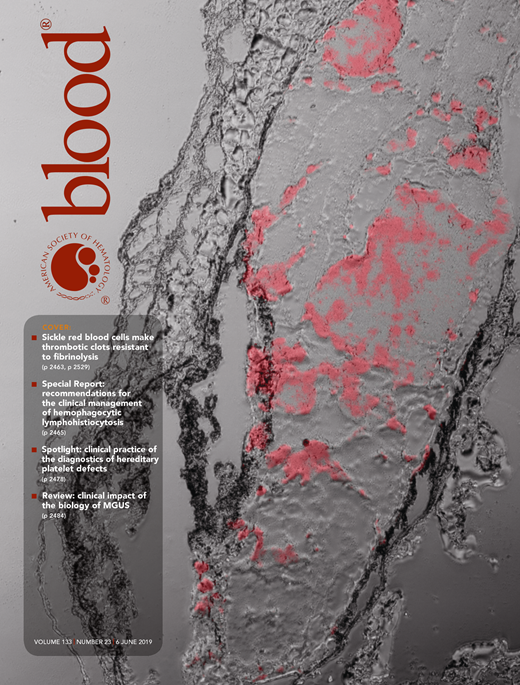 Blood Cover Image for Volume 133, Issue 23