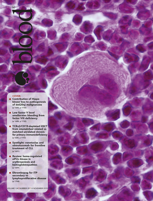 Blood Cover Image for Volume 134, Issue 20