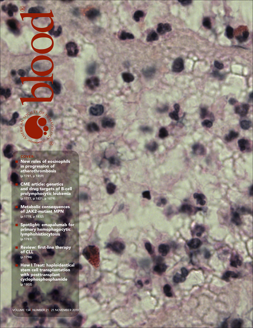 Blood Cover Image for Volume 134, Issue 21