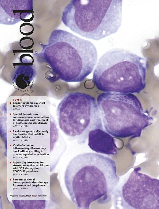 Blood Cover Image for Volume 135, Issue 22