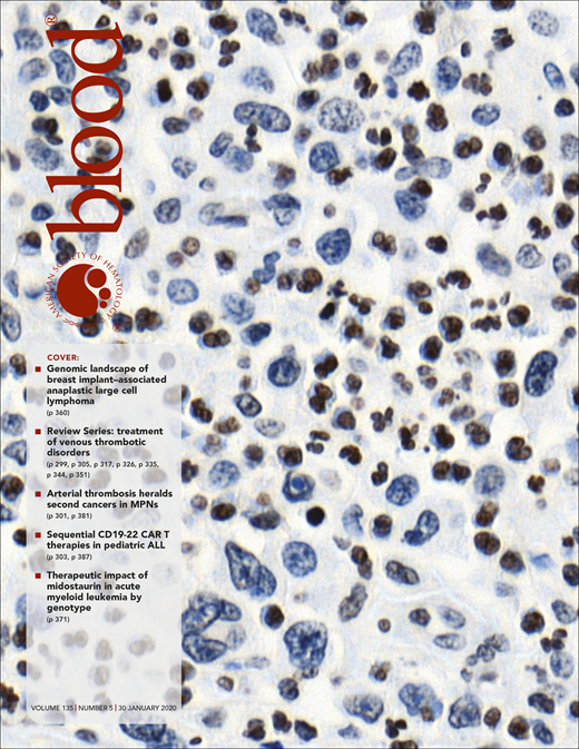 Blood Cover Image for Volume 135, Issue 5