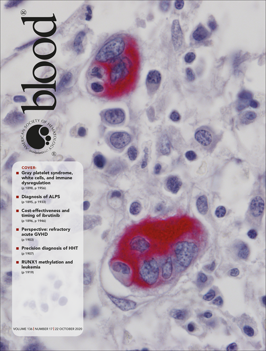 Blood Cover Image for Volume 136, Issue 17