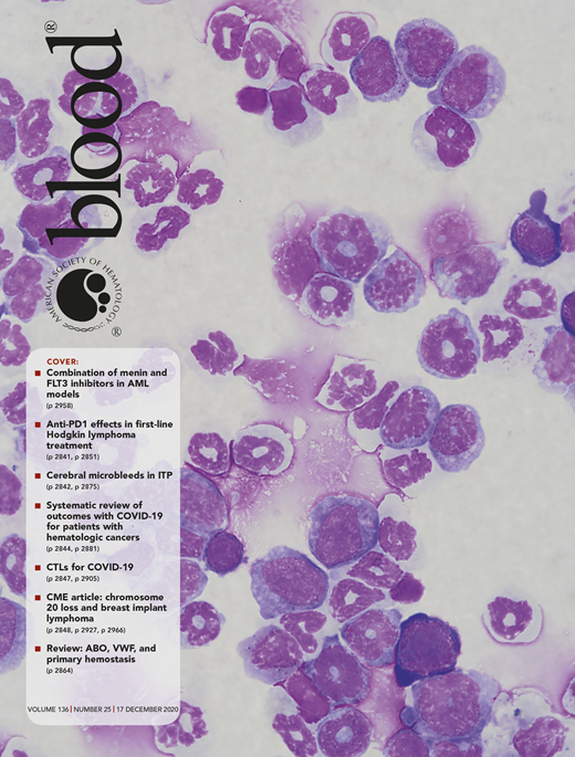 Combinatorial Treatment With Menin And Flt3 Inhibitors Induces Complete Combinatorial Treatment With Menin And Flt3 Inhibitors Induces Complete