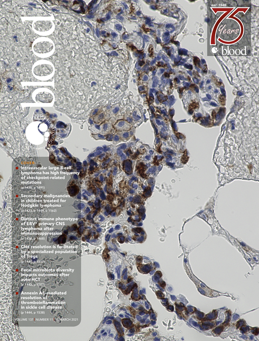 Cabot rings in acute myeloid leukemia | Blood | American Society of ...