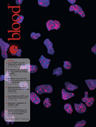 Volume 145, Issue 11 cover art