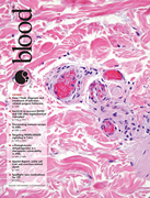 Volume 145, Issue 13 cover art