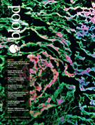 Volume 146, Issue 11 cover art