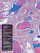 Volume 146, Issue 13 cover art