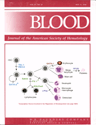 Correction of the platelet adhesion defect in delta-storage pool ...